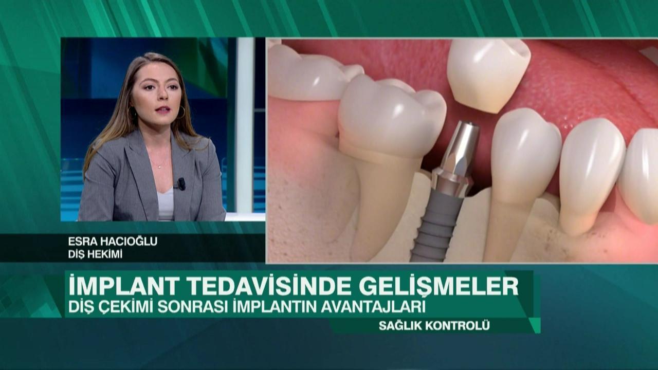 İmplant tedavisindeki son gelişmeler, kanser tedavisindeki yenilikler ve ağız ve diş bakımı Sağlık Kontrolü'nde konuşuldu