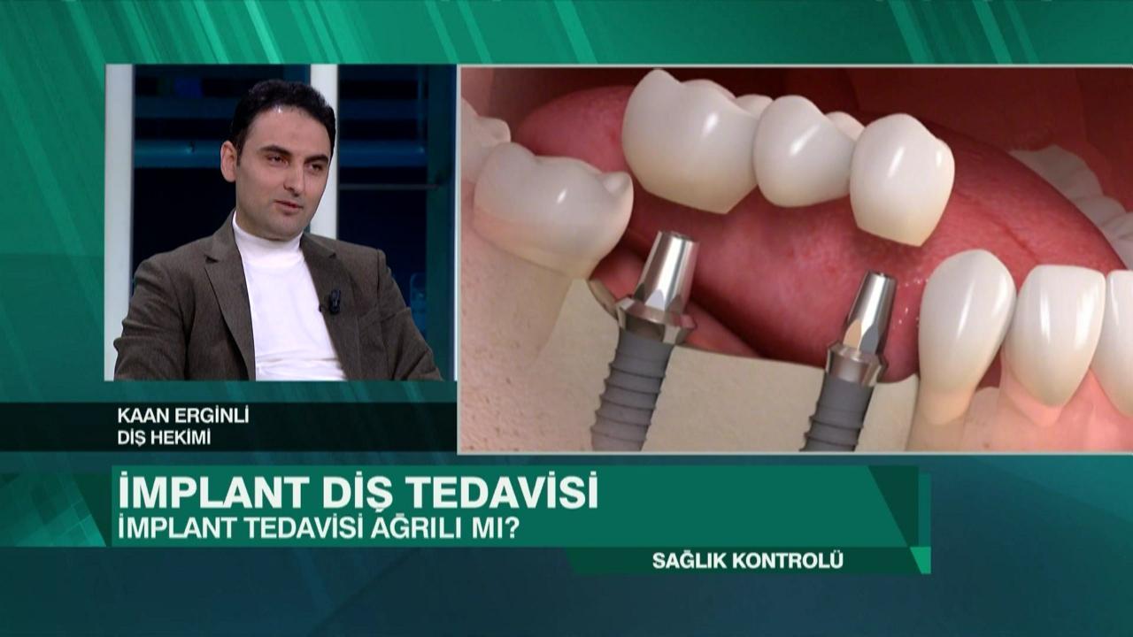 Sağlık Kontrolü, implant tedavisi, cilt gençleştirme, saten dolgu, ortodontik tedavi yöntemleri ve ameliyatsız cilt gençleştirmeyi konuştu