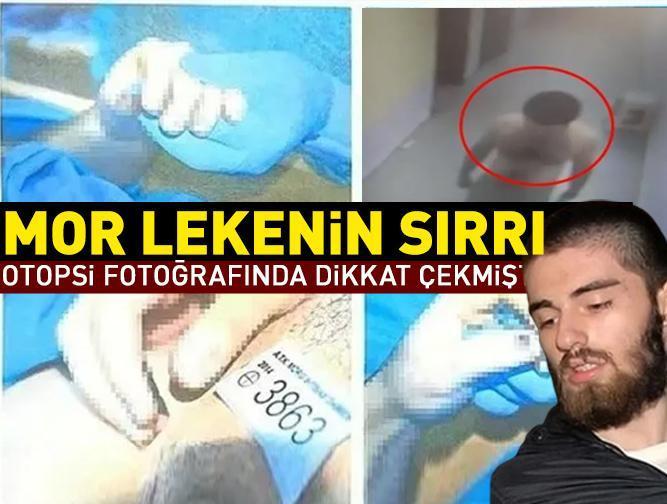 SON DAKİKA! Cem Garipoğlu'nun otopsi fotoğrafında dikkat çekmişti! 'Mor lekenin sırrı ne?'