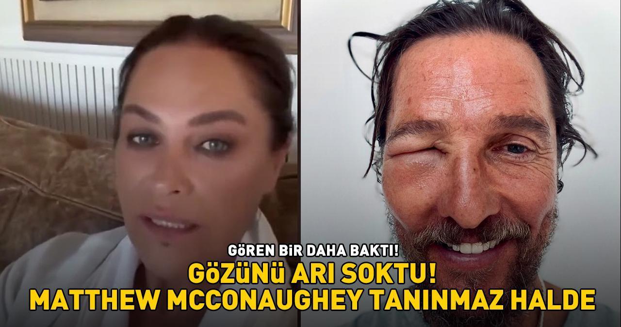 GÖZÜNÜ ARI SOKTU! Hülya Avşar ile aynı kaderi paylaştı! Hollywood yıldızı Matthew McConaughey tanınmaz halde!