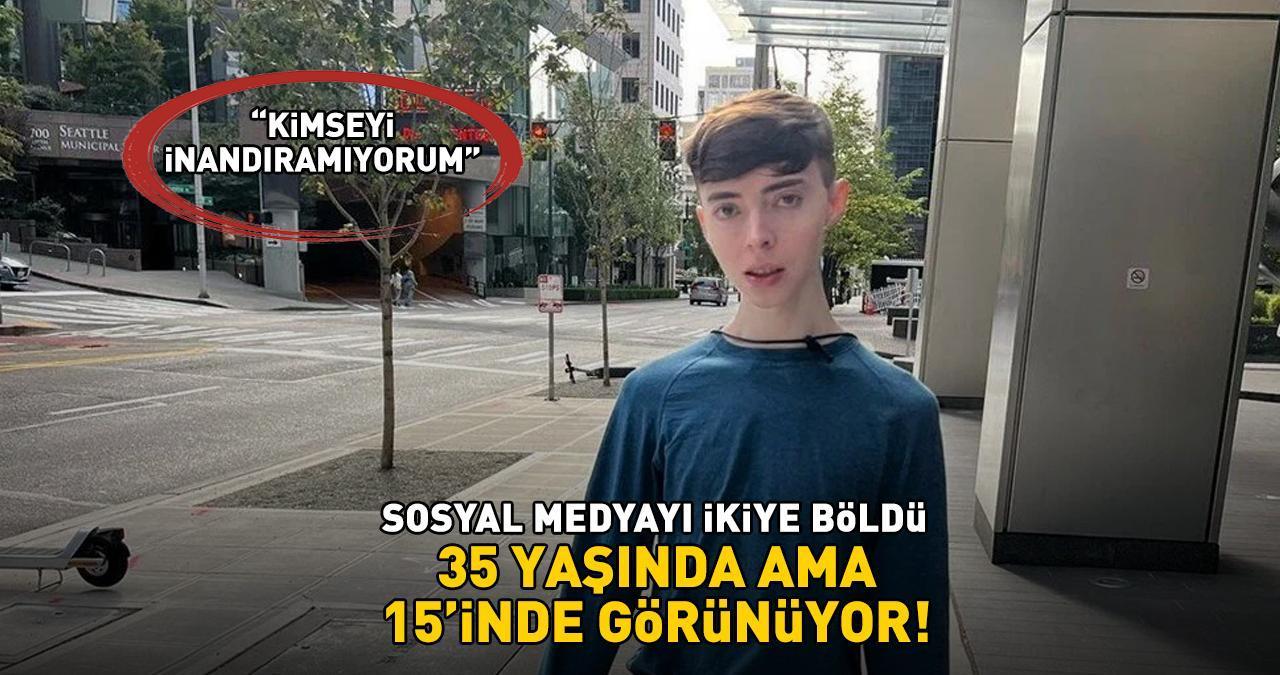 Görüntüsüyle herkesi şoke eden Instagram fenomeninin gençlik sırrı! '35 yaşında ama 15'inde görünüyor!'