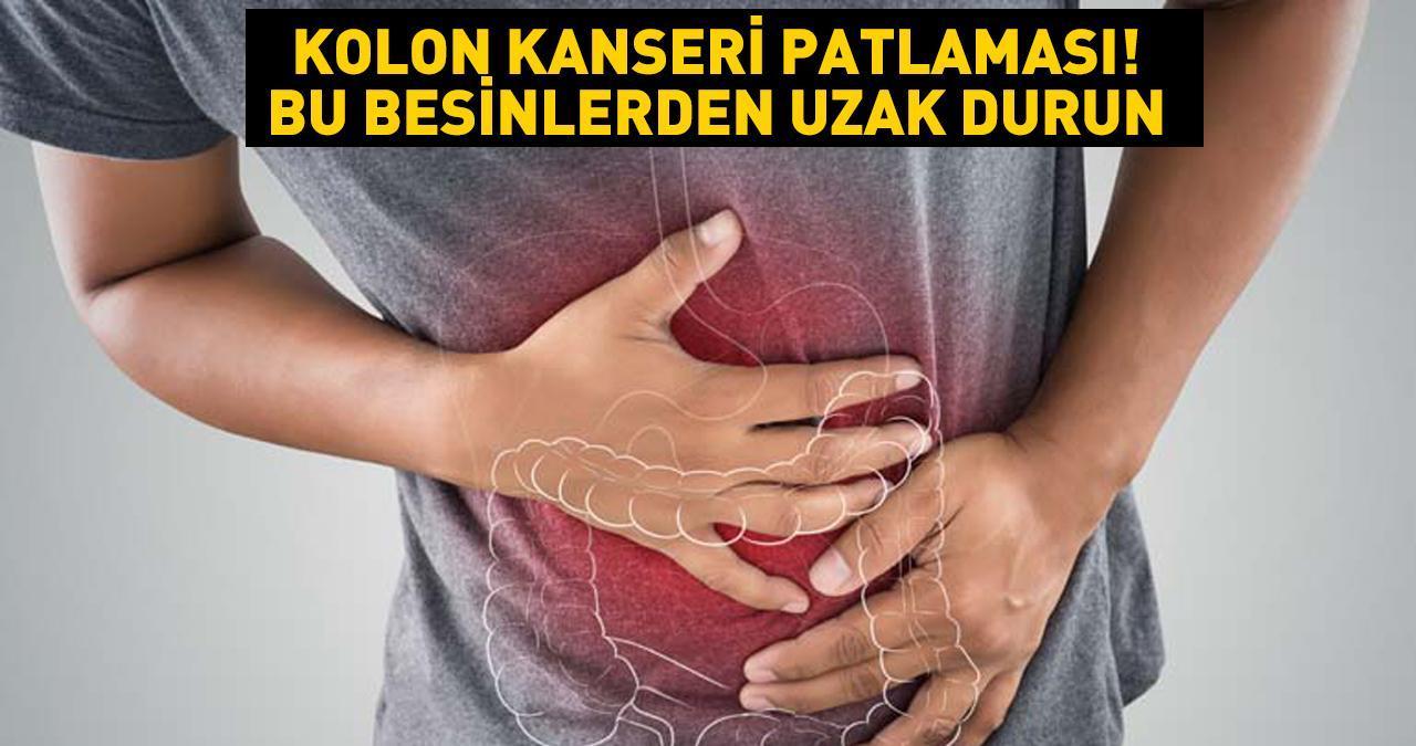 Kolon kanseri patlaması! Araştırma sonuçları ortaya koydu! İşte bu besinler bağırsakları bitiyor