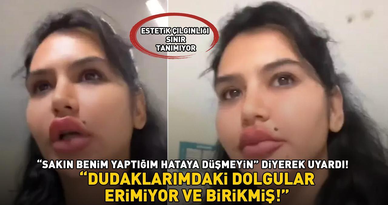 ESTETİK ÇILGINLIĞI SINIR TANIMIYOR! 'Sakın benim düştüğüm hataya düşmeyin' diyerek TikTok'tan uyardı: 'Dudaklarımdaki dolgular erimiyor!'