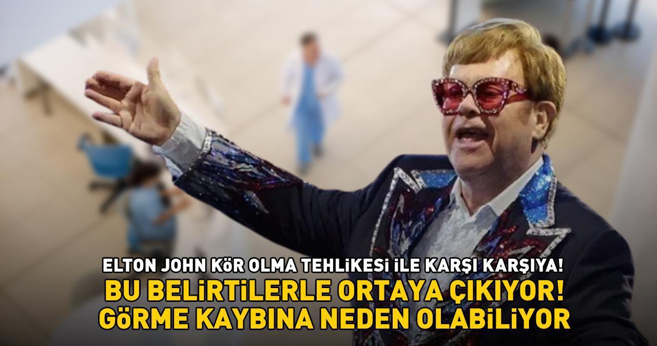 ELTON JOHN KÖR OLMA TEHLİKESİYLE KARŞI KARŞIYA! Bu belirtilerle ortaya çıkıyor, görme sorununa yol açıyor: Kaşıntı, kızarıklık, sulanma...