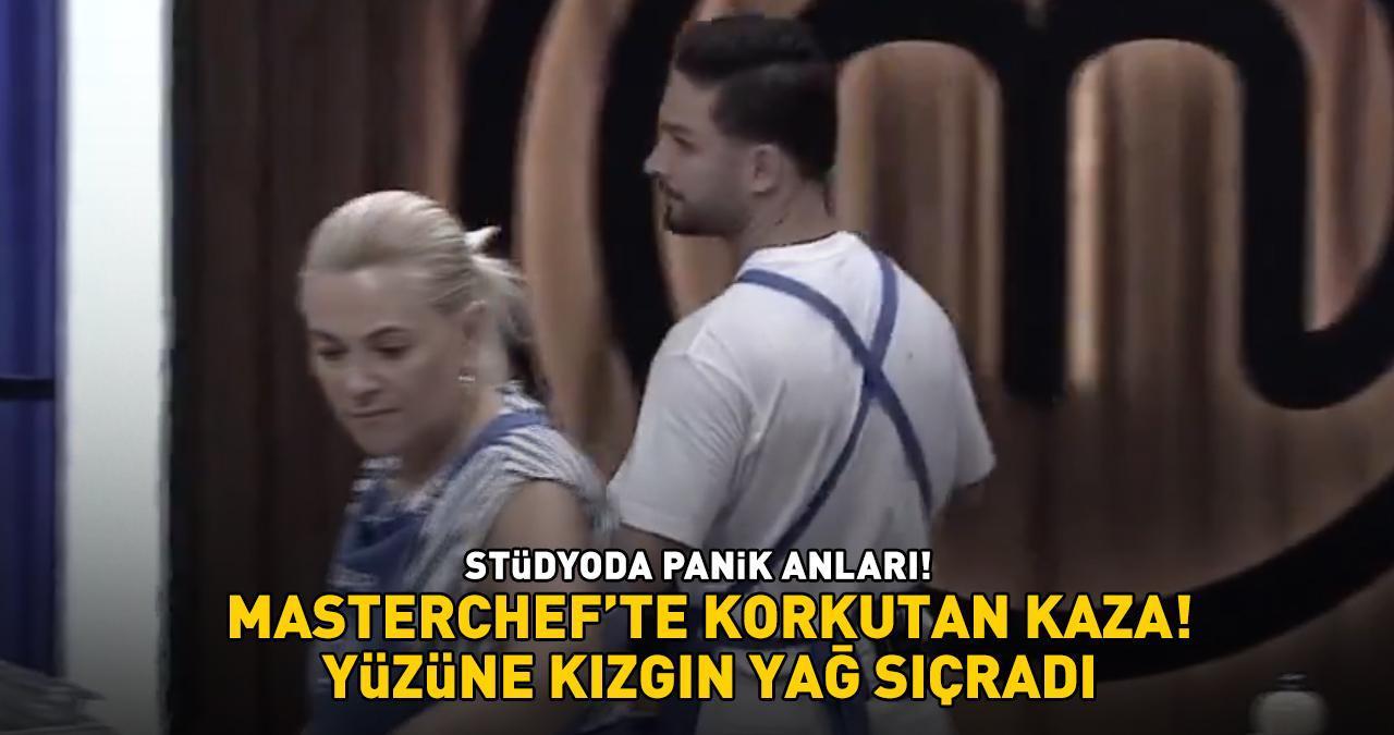 MasterChef'te 1. ve 2. eleme adayı belli oldu! Korkutan kaza! ONUR'UN YÜZÜNE KIZGIN YAĞ SIÇRADI