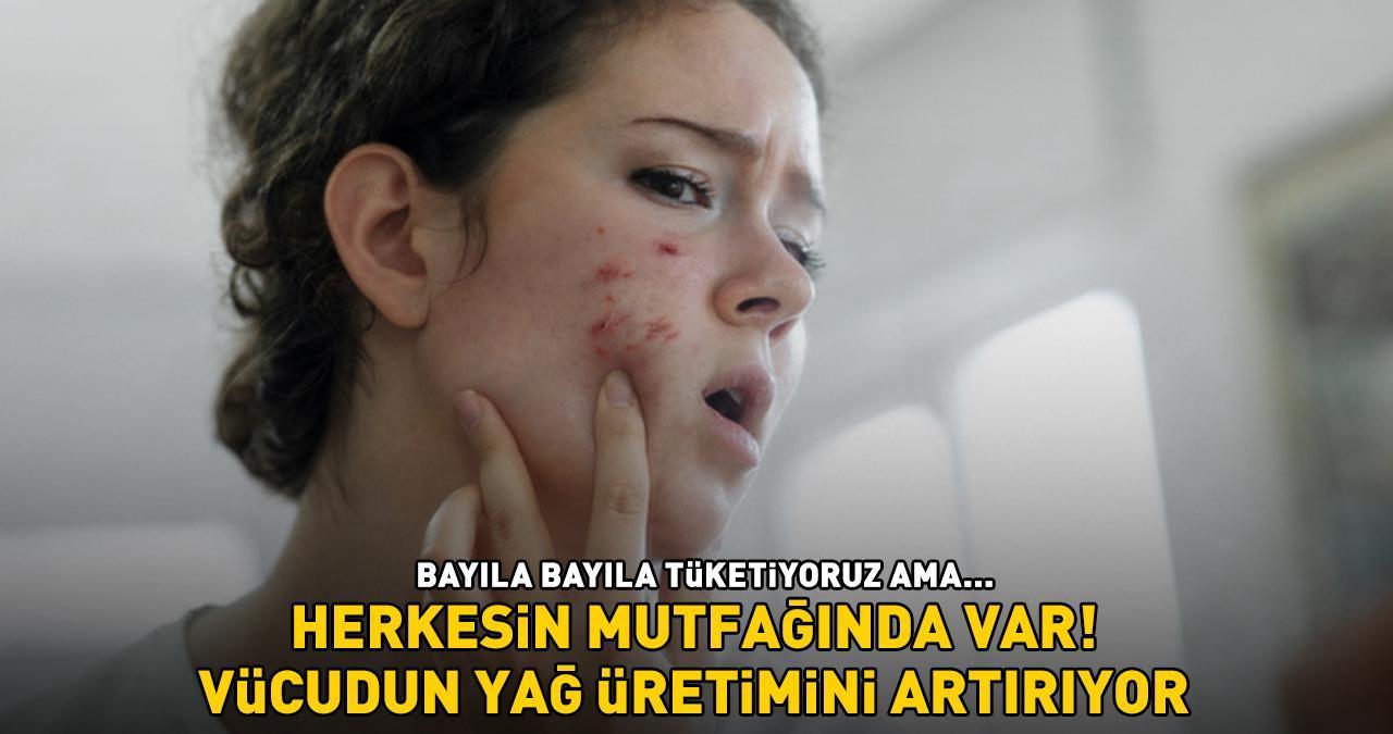 Herkesin mutfağında var! Bayıla bayıla tüketiyoruz ama sivilce ve siyah nokta çıkarıyor! 'YAĞ ÜRETİMİNİ ARTIRIYOR'