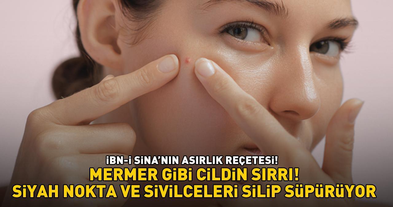 İBN-İ SİNA'NIN ASIRLIK REÇETESİ! Siyah nokta, akne ve sivilceleri silip süpürüyor! 'MERMER GİBİ CİLDİN SIRRI!'