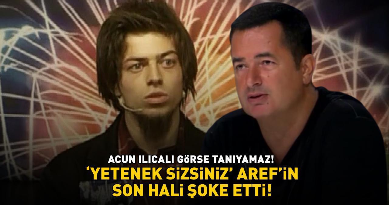 ACUN ILICALI GÖRSE TANIYAMAZ! 'Yetenek Sizsiniz' Aref'in son hali şoke etti