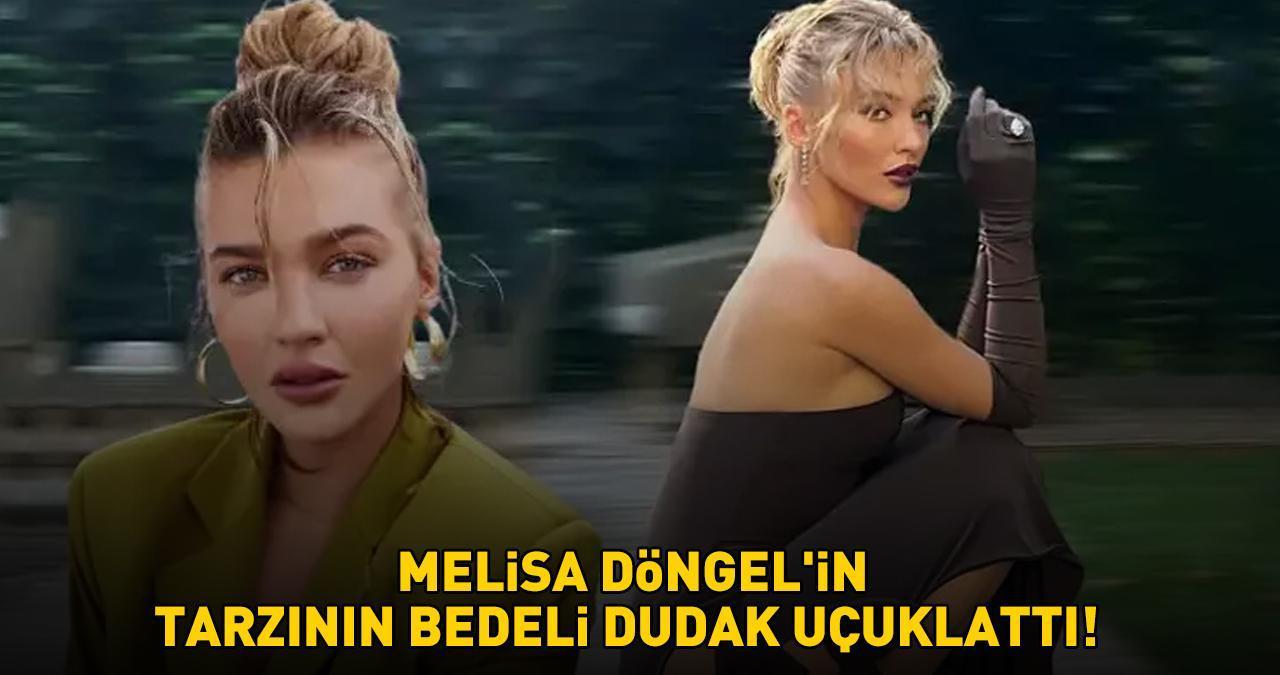 MELİSA DÖNGEL'İN TARZININ BEDELİ DUDAK UÇUKLATTI! Binlerce liralık elbise