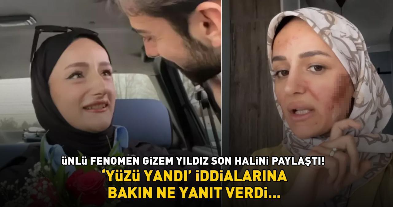 'Amin Reis' lakaplı fenomen Gizem Yıldız son halini paylaştı! Yüzünün yandığı iddia edilmişti, meğer gerçek başkaymış!