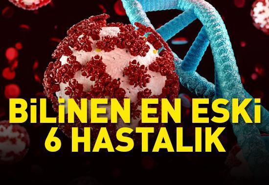 Tarihten günümüze BİLİNEN EN ESKİ 6 HASTALIK! Milyarlarca insanı etkiledi