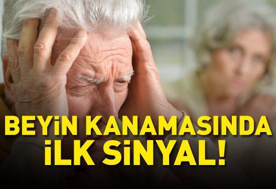 Beyin kanamasının en önemli belirtisi... Mevsim geçişlerinde riski daha da artıyor! Özellikle bu aylara dikkat