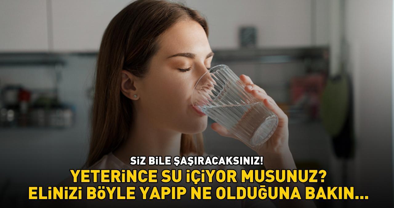 Yeterince su içiyor musunuz? Elinizi böyle yapıp ne olduğuna bakın! Sonuç sizi bile şaşırtacak