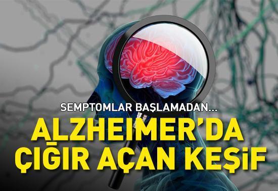 ALZHEIMER'DA ÇIĞIR AÇAN ÇALIŞMA: Semptomlar başlamadan tedavi edilebilecek! Alzheimer'da bilinen 10 belirti