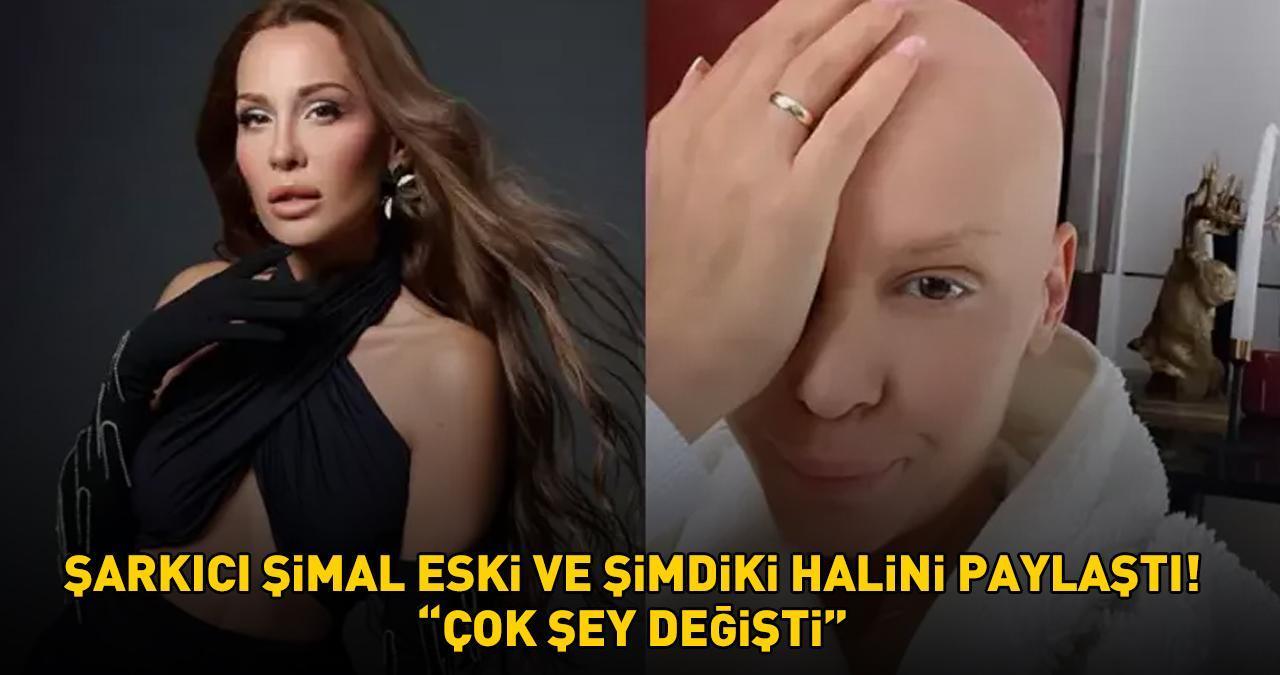 Kanserle mücadele eden Şimal eski ve şimdiki halini paylaştı: 'ÇOK ŞEY DEĞİŞTİ!'