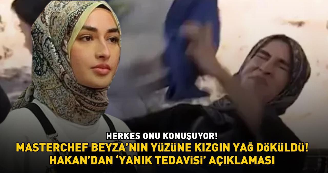 SON DAKİKA HABERİ: Yüzüne kızgın yağ dökülen MasterChef Beyza korkuttu! Hakan'dan açıklama geldi