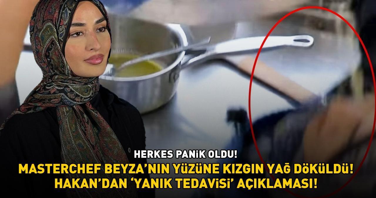 SON DAKİKA HABERİ: Yüzü yanan MasterChef Beyza korkuttu! Hakan genç kızın sağlık durumunu açıkladı