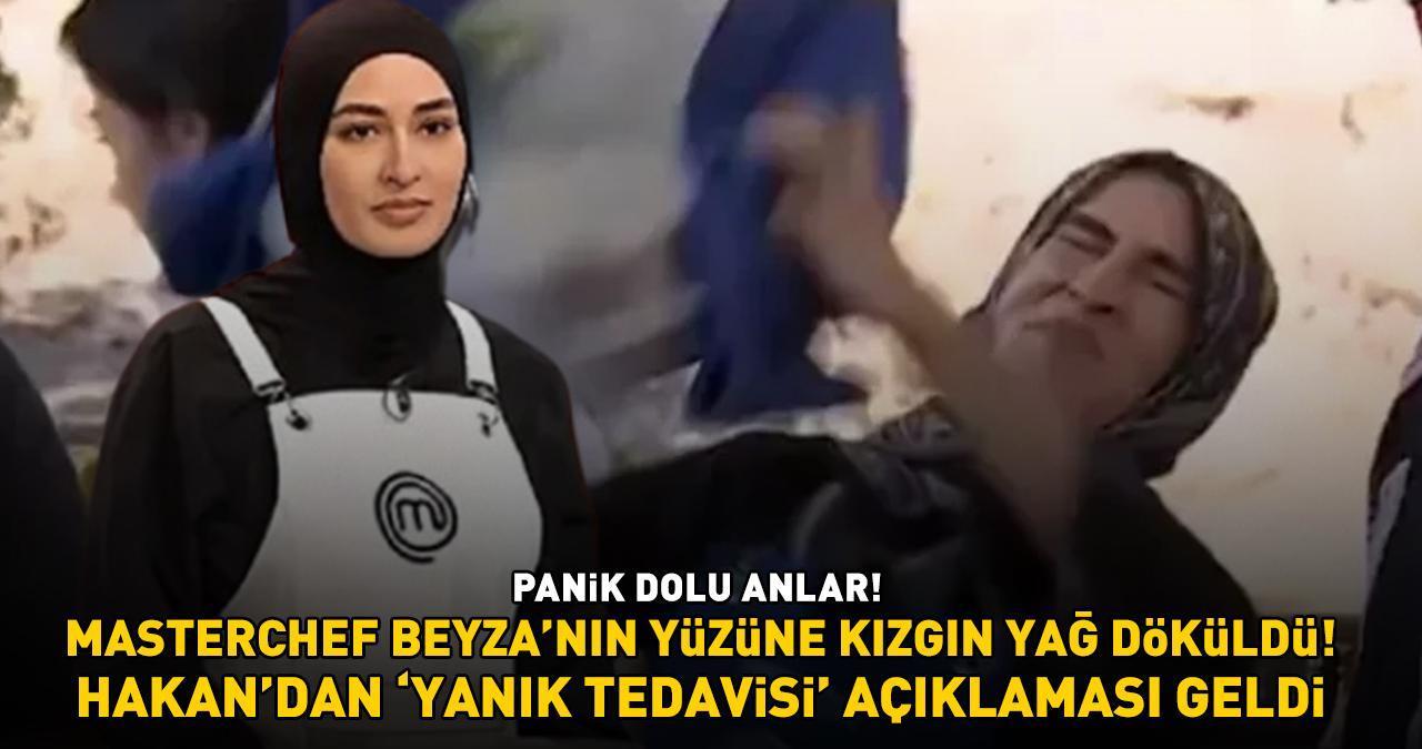 SON DAKİKA HABERİ: Yüzüne kaynar yağ dökülen Beyza acil olarak hastaneye kaldırıldı! Hakan'dan açıklama geldi