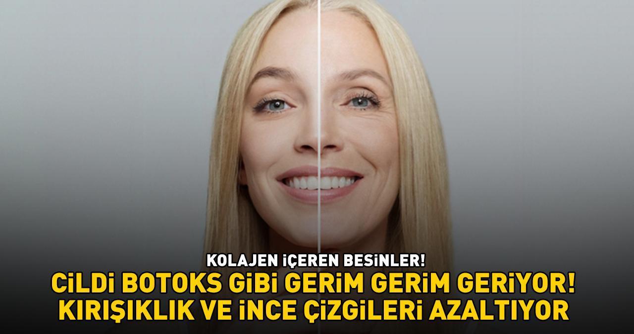 KOLAJEN İÇEREN BESİNLER! 'Cildi Botoks Gibi Gerim Gerim Geriyor, Kırışıklık Ve İnce Çizgileri Azaltıyor'