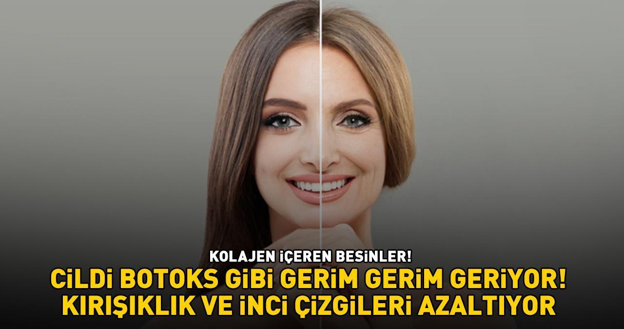 DOĞAL KOLAJEN KAYNAĞI BESİNLER! 'Cildi Botoks Gibi Gerim Gerim Geriyor, Kırışıklık Ve İnce Çizgileri Azaltıyor!'