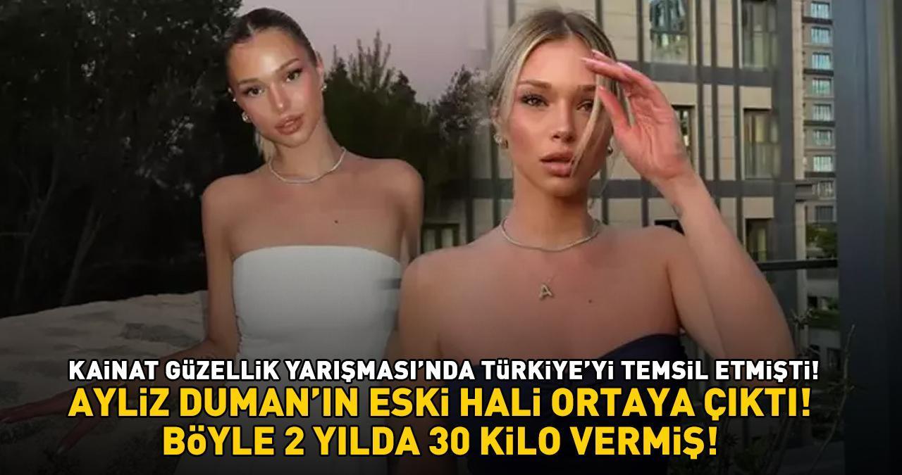 Kainat Güzellik Yarışması'nda Türkiye'yi temsil eden Ayliz Duman'ın eski hali ortaya çıktı! Meğer böyle 2 yılda 30 kilo vermiş!