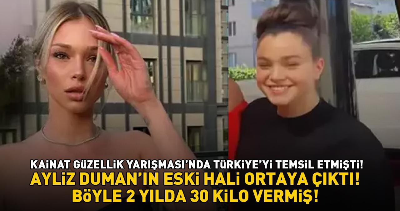 Kainat Güzellik Yarışması'nda Türkiye'yi temsil eden Ayliz Duman'ın eski hali ortaya çıktı! Meğer böyle 2 yılda 30 kilo vermiş!