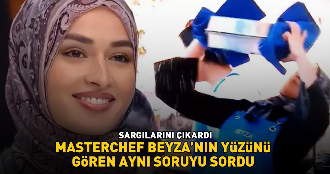 YÜZÜ YANMIŞTI! MasterChef Beyza sargılarını çıkarınca herkes şoke oldu: 'EN UFAK YARA İZİ YOK!'