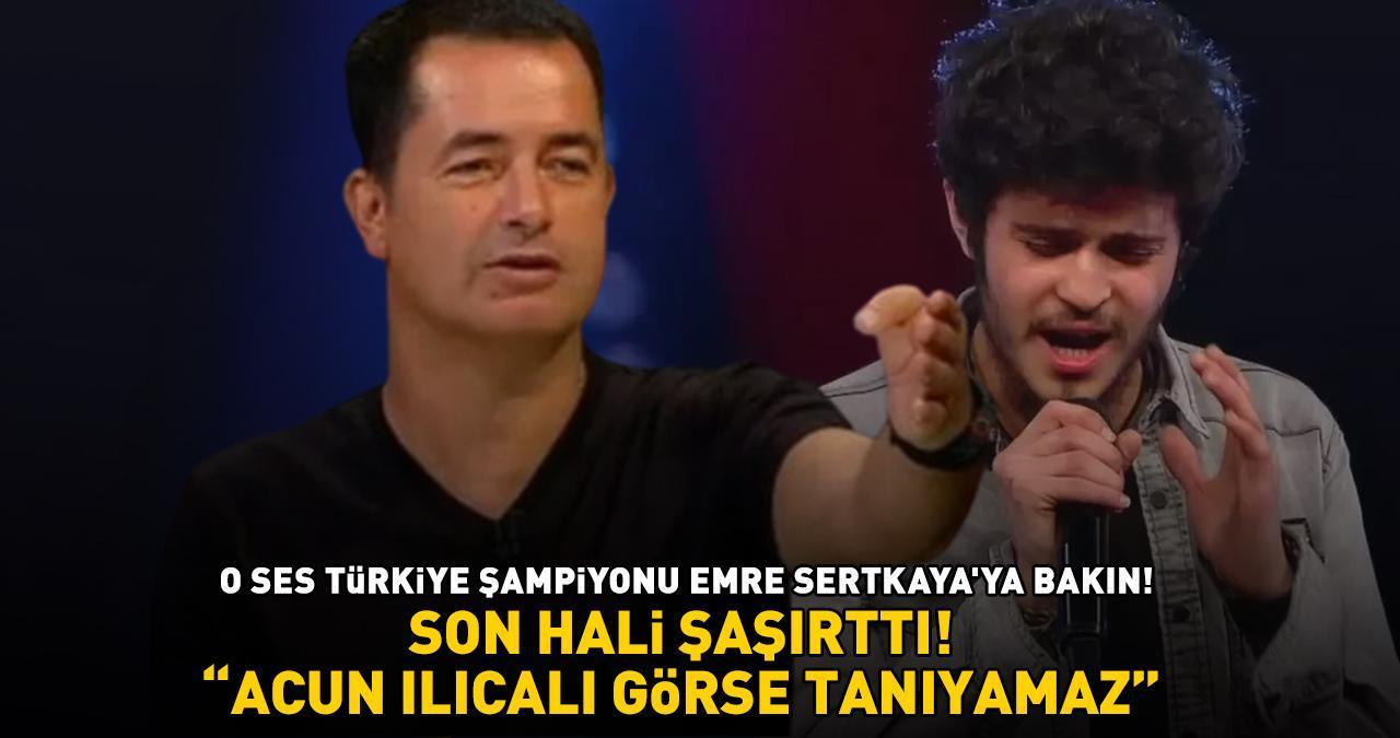 O Ses Türkiye şampiyonu Emre Sertkaya'nın son hali şoke etti! ‘ACUN ILICALI GÖRSE TANIYAMAZ!’