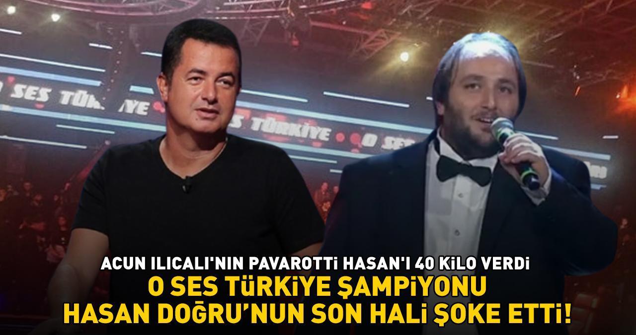 O Ses Türkiye şampiyonu Hasan Doğru'nun son hali şaşırttı! ACUN ILICALI'NIN PAVAROTTİ HASAN'I İĞNE İPLİĞE DÖNDÜ