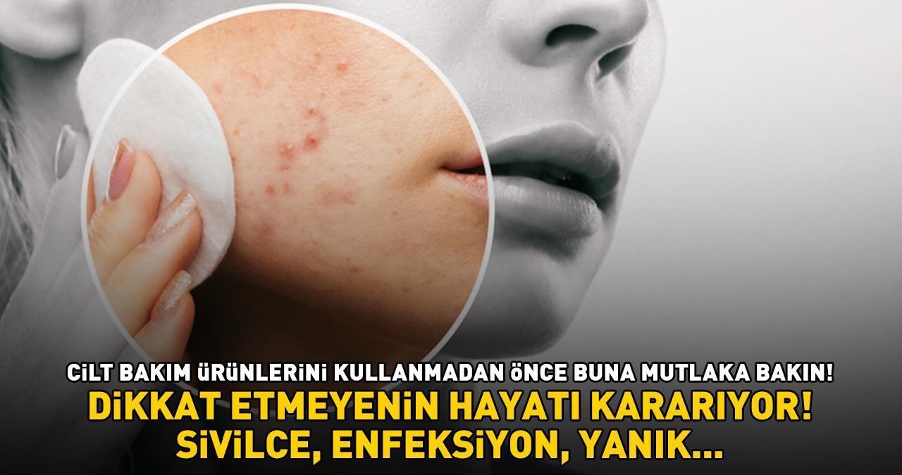 SİVİLCE, ENFEKSİYON, YANIK! Cilt bakım ürünlerini kullanmadan önce mutlaka bakın! Dikkat etmeyenin hayatı kararıyor