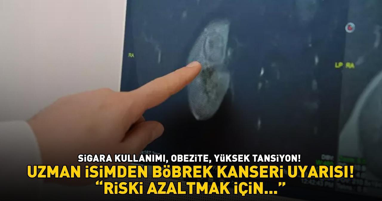 SİGARA KULLANIMI, OBEZİTE, YÜKSEK TANSİYON! Uzman isimden böbrek kanseri uyarısı: ‘Riski azaltmak için…’