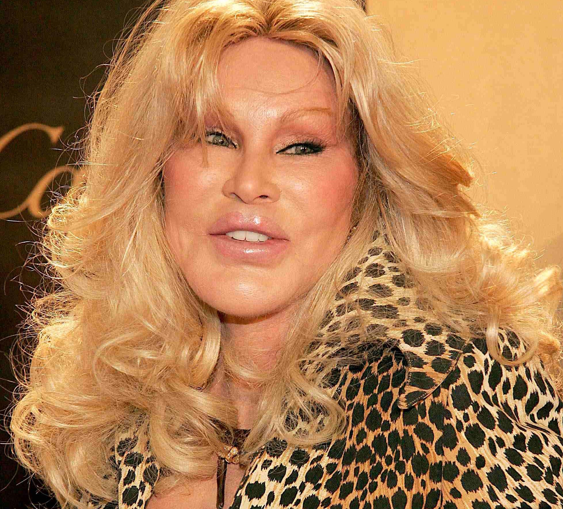 'Kedi Kadın' Jocelyn Wildenstein hayatını kaybetti: Ölüm nedeni açıklandı...