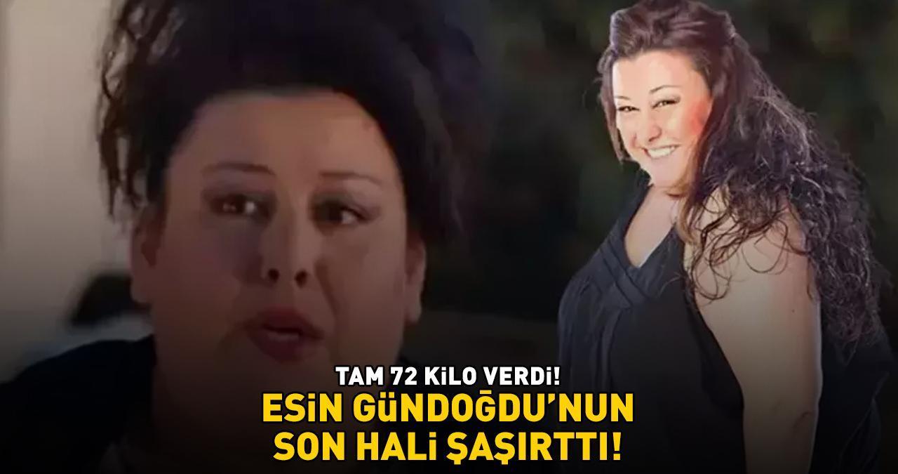 Kocan Kadar Konuş'un Saniye'si Esin Gündoğdu'nun son hali şaşırttı! Tam 72 kilo verdi!