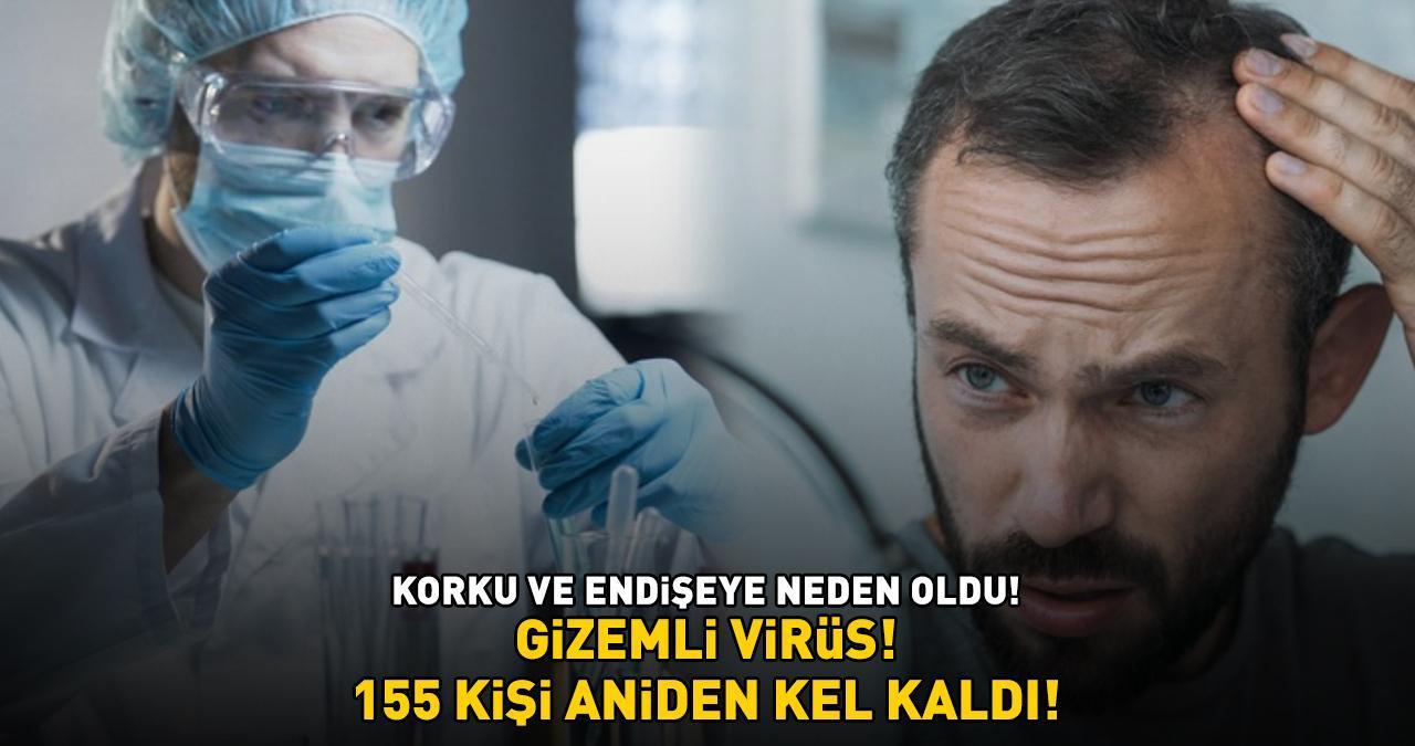 155 KİŞİ ANİDEN KEL KALDI! Koronavirüs, HMPV ve Norovirüs'ten sonra şimdi de bu! Gizemli virüs korku ve endişeye neden oldu