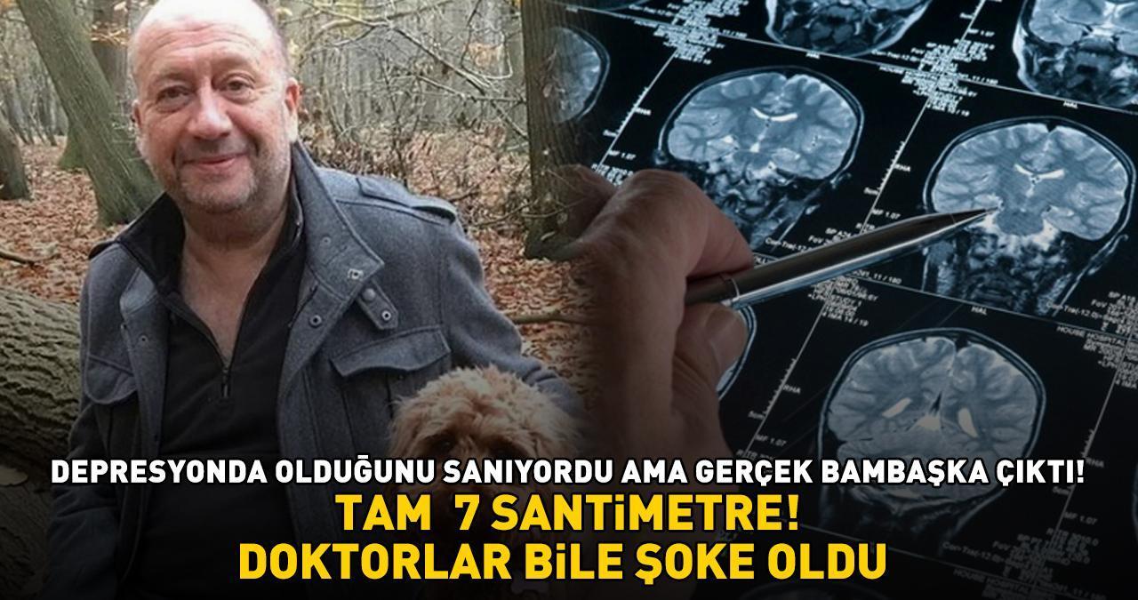 Depresyonda olduğunu sanıyordu, gerçek çok farklı çıktı! Doktorlar bile şaşırdı! TAM  7 SANTİMETRE BOYUNDA!