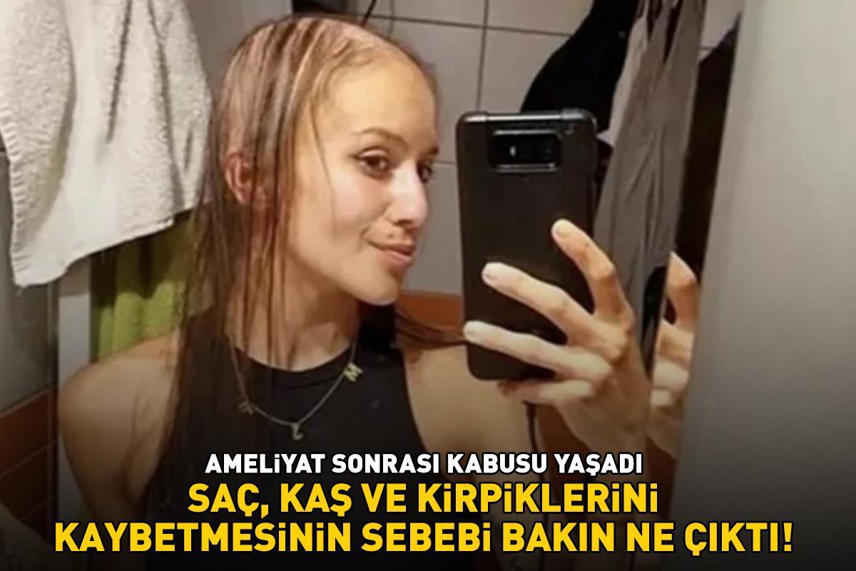 Güzelleşmek için bıçak altına yattı, ameliyat sonrası kabusu yaşadı! Saç, kaş ve kirpiklerini kaybetmesinin sebebi bakın ne çıktı!