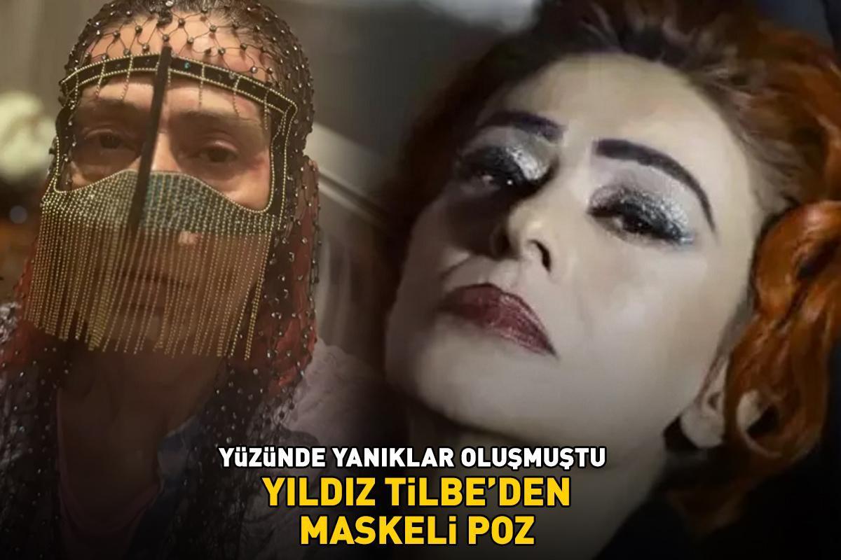 Yüzünde yanıklar oluşmuştu! YILDIZ TİLBE'DEN MASKELİ POZ