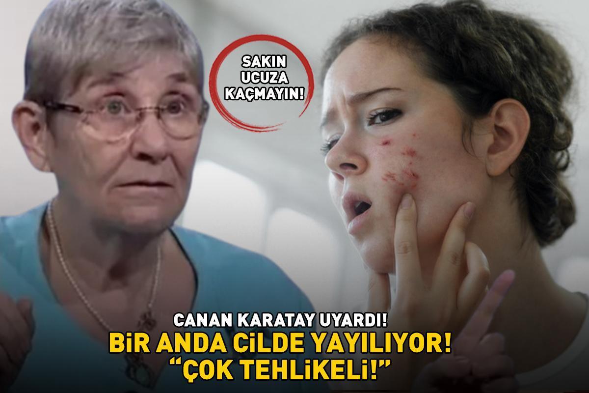 Sakın ucuza kaçmayın! Canan Karatay uyardı: 'Çok tehlikeli!' Akne ve sivilceler bir anda cilde yayılıyor