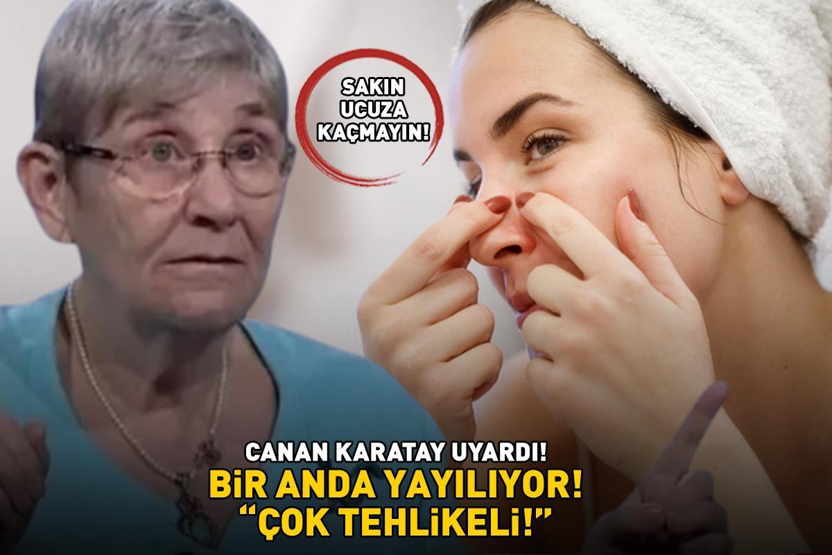 ‘ÇOK TEHLİKELİ!’ Akne ve sivilceler bir anda cilde yayılıyor! Prof. Dr. Canan Karatay uyardı: ‘Ucuza kaçıp en kötüsünü almayın!’