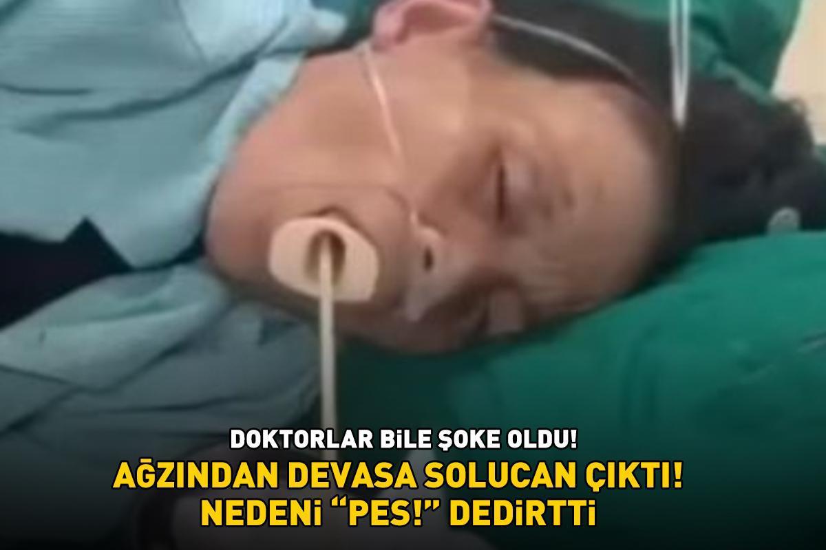 Doktorlar bile şoke oldu! Ağzından devasa solucan çıktı! Nedeni 'Pes!' dedirtti