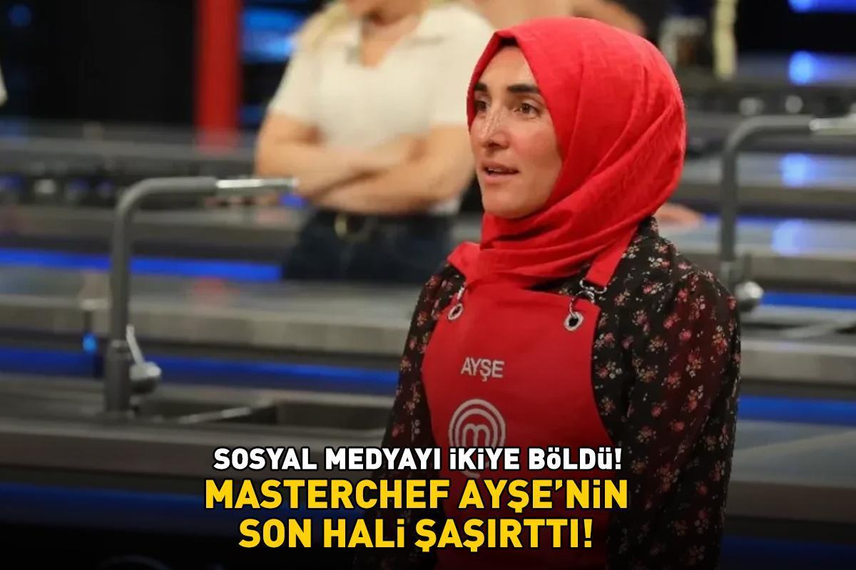 MasterChef Ayşe Ekiz'in son hali şoke etti! Estetikli görüntüsü sosyal medyayı 2'ye böldü