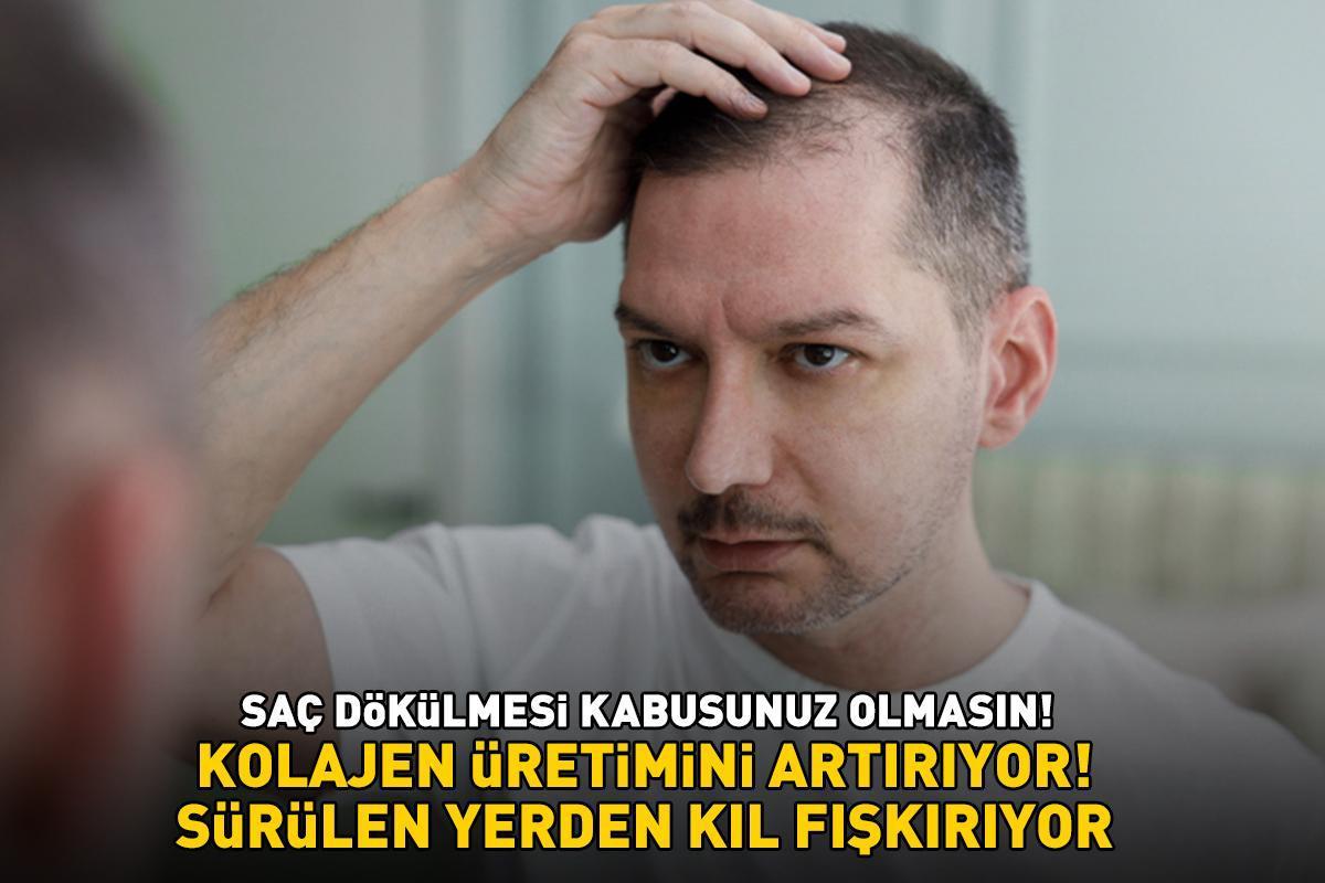 Saç dökülmesi sorunu için 5 kat daha etkili formül! Sürülen yerden kıl fışkırıyor! Kolajen üretimini artırıyor, saç derisi iltihabını azaltıyor