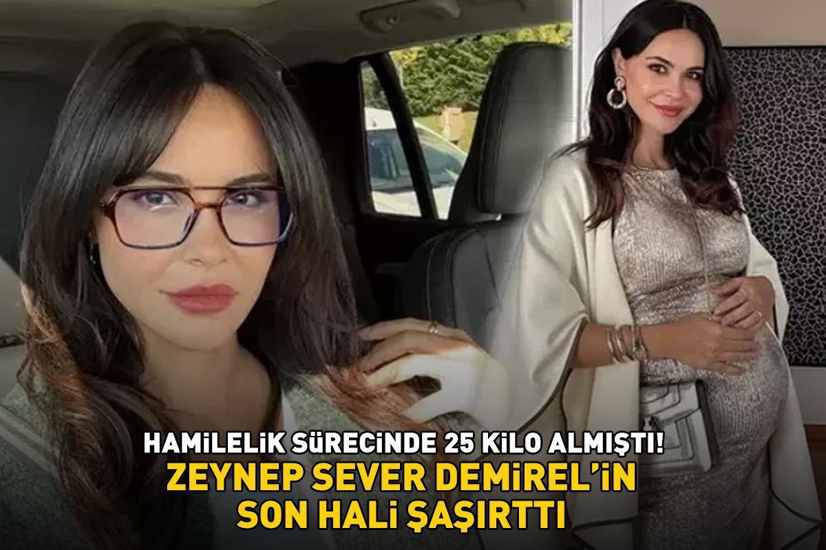 Hamilelik sürecinde 25 kilo almıştı! Volkan Demirel'in güzeller güzeli eşi Zeynep Sever Demirel son halini paylaştı