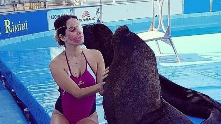 Asit saldırısına uğrayan model yaşama tutunmaya çalışıyor
