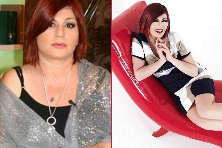 Mide küçültme ameliyatı olan ünlüler
