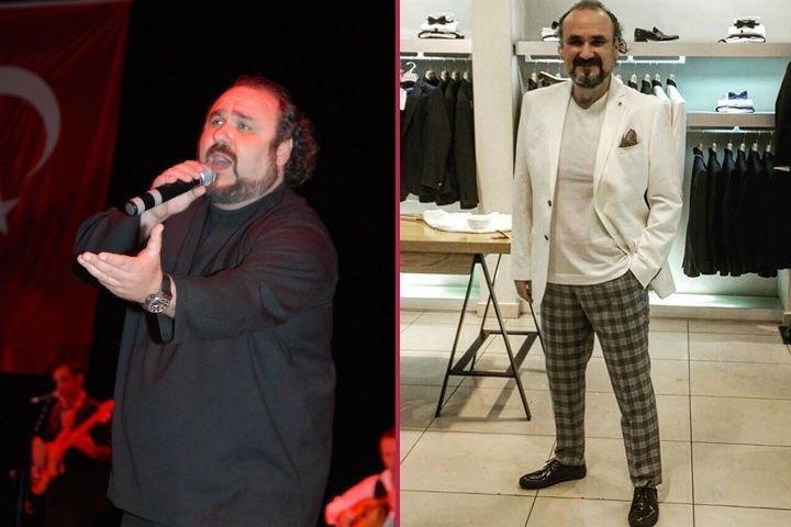 Mide küçültme ameliyatı olan ünlüler