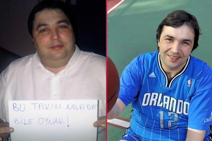 Mide küçültme ameliyatı olan ünlüler