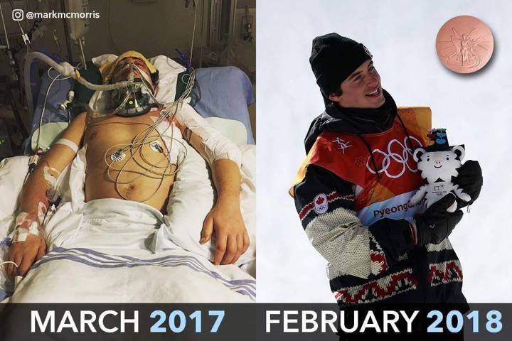 11 ay önce ölümle pençeleşiyordu bugün olimpiyatlarda madalya kazandı
