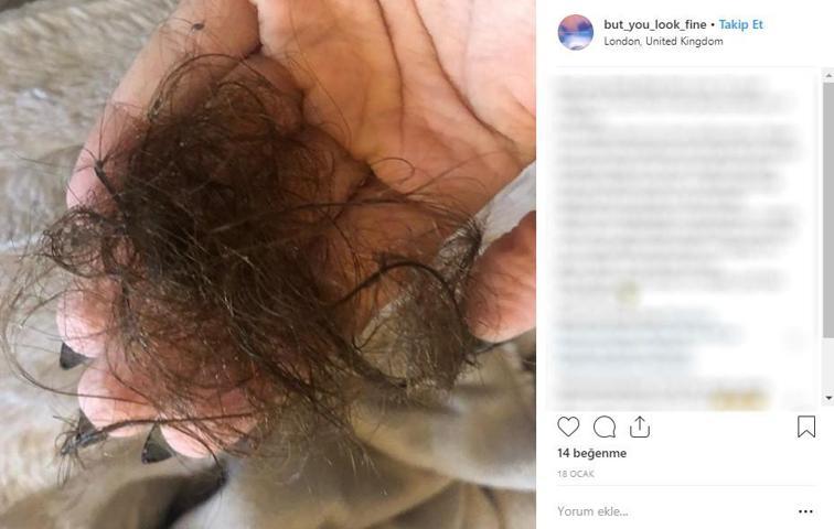 Yüzü bir anda bu hale geldi Sebebini öğrenince kulaklarına inanamadı