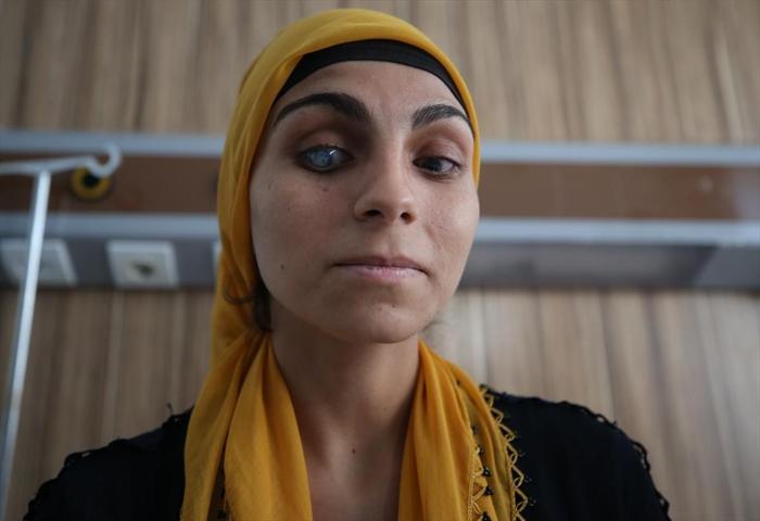 21 yıl sonra ilk kez dünyayı gördü... Sanki yeniden dünyaya gelmiş gibiyim